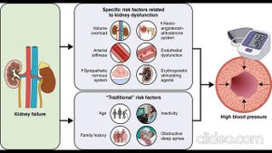 Подбор гипотензивных препаратов при гемодиализе: Сравнение рисков падения давления (ИДГ)