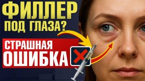 Носослезная борозда старит на 10 лет! Почему НЕЛЬЗЯ закачивать носослезную борозду филлерами?