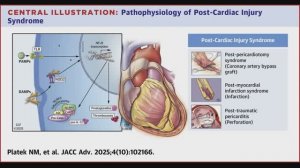 Посткардиальный синдром: сдвиг парадигмы, новая диагностика (МРТ) и таргетное лечение IL-1