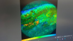 Все еще только конфокальный лазерный микроскоп 20251030_193326