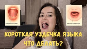 Короткая уздечка языка! Чем она опасна и что делать?