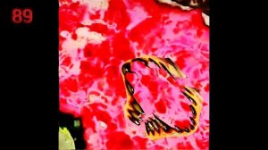 mr incredible becoming uncanny phase 88-90