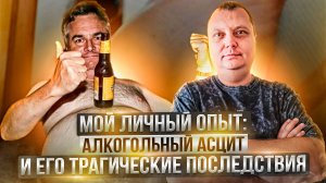 Алкогольный асцит и его трагические последствия - Мой личный опыт