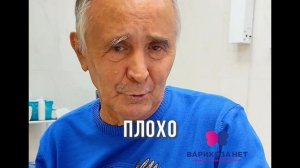 Варикоза нет | Отзыв пациента, который оттягивал лечение