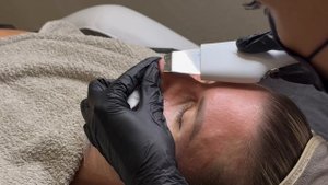 Комплексная чистка лица от косметолога Natural Beauty