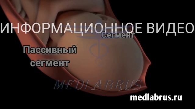 Вагинальные роды-Первая стадия родов: 3D-анимация процесса и симптомы смотреть онлайн
