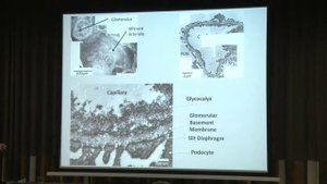 Visualising and reconstructing the glycocalyx - Kenton Arkill 2014