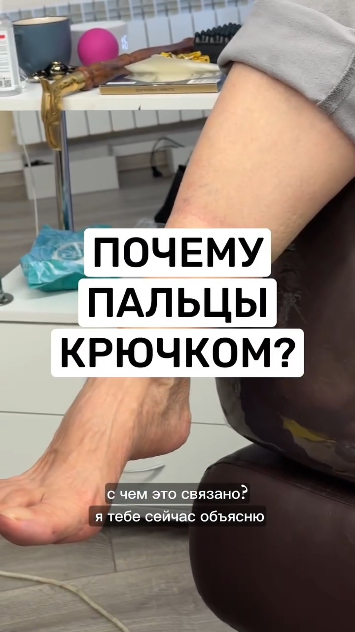 Как исправить молоткообразные пальцы.  Востановить правильную геометрию, зафиксировать эту геометрию смотреть онлайн