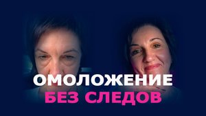 Блефаропластика и эндолифтинг лба: естественное омоложение лица