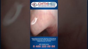 Работа видеобронхоскопов Mindsion BF52/BF58+VS100+WT200, беспроводное подключение