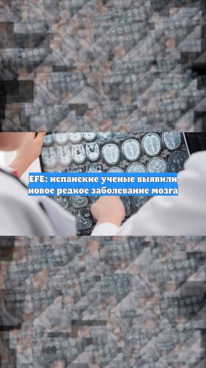 EFE: испанские ученые выявили новое редкое заболевание мозга