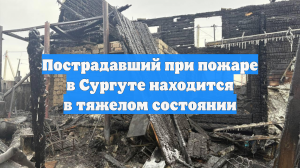 Пострадавший при пожаре в Сургуте находится в тяжелом состоянии