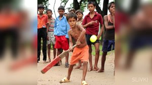 Топ5 ЛЮДЕЙ С ЛИШНИМИ ЧАСТЯМИ ТЕЛА