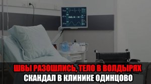 Залечили до смерти за 4 миллиона: семья из Одинцово обвиняет клинику в гибели матери