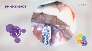 Клинические случаи PROPHYﬂex 4