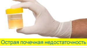 Острая почечная недостаточность. Часть 2. Диагностика