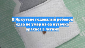 В Иркутске годовалый ребенок едва не умер из-за кусочка арахиса в легких