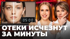 Как убрать отеки с лица? Простые и рабочие способы! Проверяем советы блогеров
