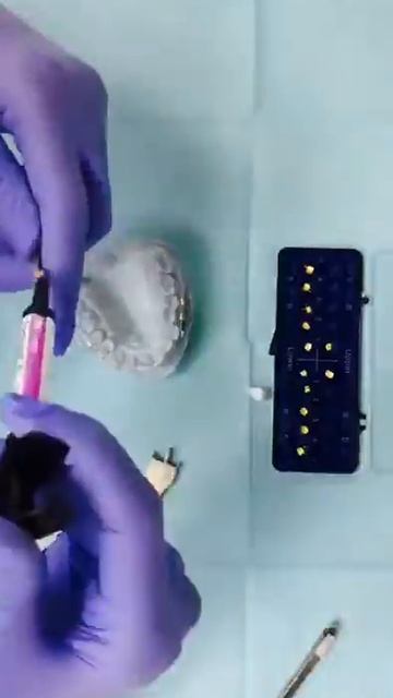 ЧЕМ ЗАНИМАЕТСЯ ОРТОДОНТ, КОГДА ОН ОДИН