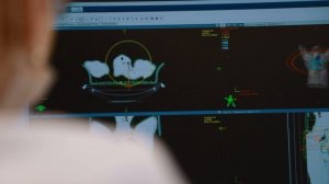 Лечение рака лёгкого - Линейный ускоритель