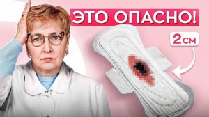 СГУСТКИ при менструации. Главные признаки НОРМАЛЬНЫХ месячных. СРОЧНО проверьте себя