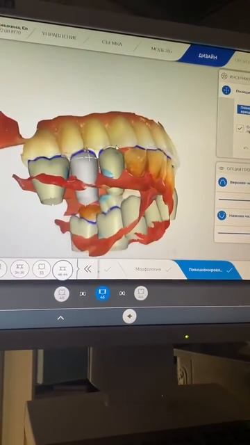 МОДЕЛИРОВАНИЕ ОРТОПЕДИЧЕСКОЙ РАБОТЫ