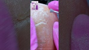 фрезы в обработке глубоких трещиня сменила их в работе четыре, и, кстати в заметили что-то в глуби