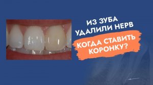 Депульпировали зуб. Нужна ли коронка?