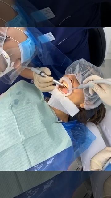 ЧИСТКА ЗУБОВ НА БРЕКЕТАХ