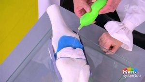 Причины боли в суставах, о которых вы не подозревали. Жить здорово! Фрагмент выпуска от 07.11.2025