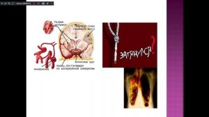 тема № 15 231-8.11.25,251-10.11.25 курение и его влияние на состояние здоровья