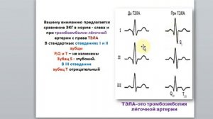 17 2. .Гаева С.Ж. Лекция  34 ч 2 Физиология сердца
