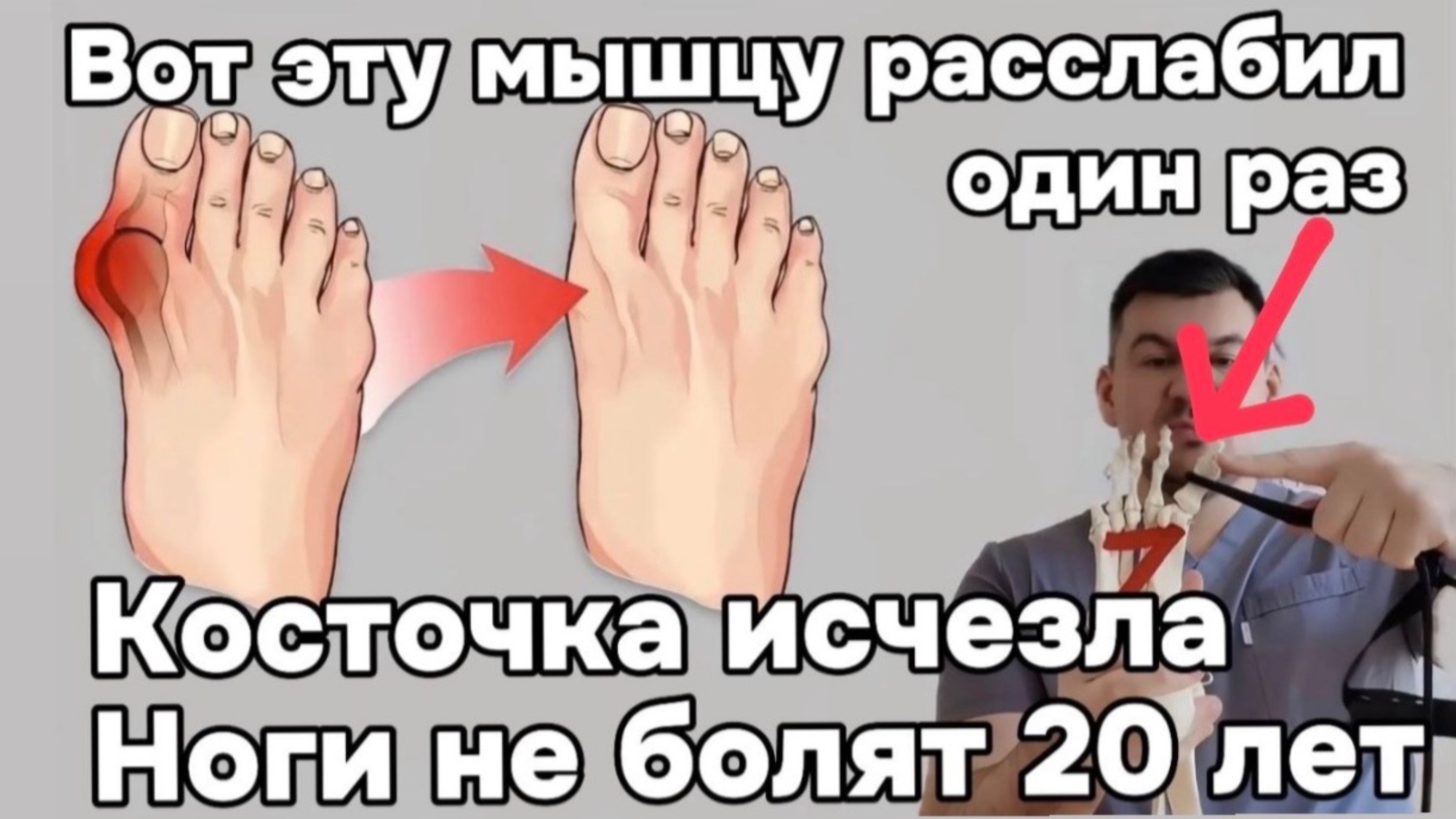 Косточка на стопе исчезает навсегда. Расслабил эту мышцу и ноги не болят уже 20 лет смотреть онлайн