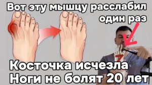 Косточка на стопе исчезает навсегда. Расслабил эту мышцу и ноги не болят уже 20 лет