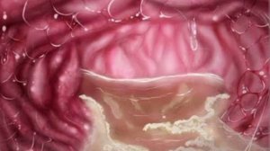 MISIDE VORE / SLEPPY MITA VORE AUDIO