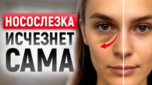 Рабочий способ избавиться от носослезной борозды легко без операций!Этот секрет красоты и молодост