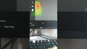 Операция, 1 серия (Начало]