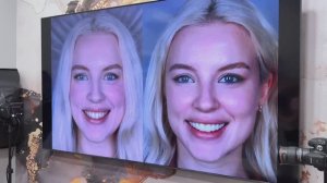 Примерка Виниров До/После ❘ Клиника WeekSmile