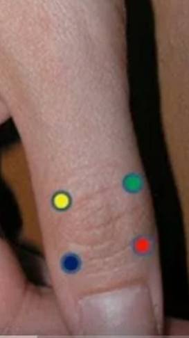 Четыре точки лечения