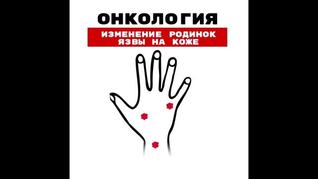 ЦОЗ - онкология