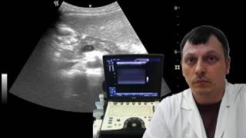 Детское УЗИ брюшной полости - Спонтанное контрастирование воротной вены (мононуклеоз) смотреть онлайн