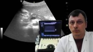 Детское УЗИ брюшной полости - Спонтанное контрастирование воротной вены (мононуклеоз)