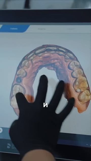 Сколько стоит голивудская улыбка? #виниры #винирыsmilegallery