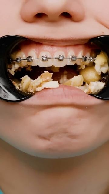 Какая вкусняшка сломает брекет? смотреть онлайн