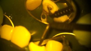 Ивлев Юрий - Фиксация кварцевого штифта плюс build-up