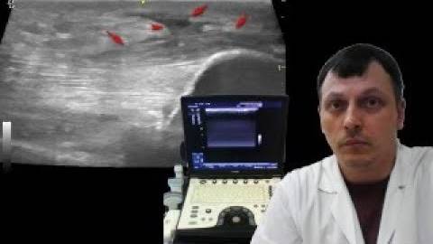 Детское УЗИ мягких тканей - Локоть хоккеиста смотреть онлайн