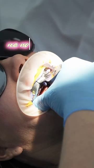 #винирыsmilegallery от 36000₽/1 ед.  запись по номеру 8 (800) 600 00 56