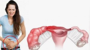 Внематочная беременность причины и лечение