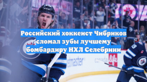 Российский хоккеист Чибриков сломал зубы лучшему бомбардиру НХЛ Селебрини