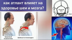 Связь атланта и сухожильного шлема - основа жизни мозга. Упражнения для разблокировки